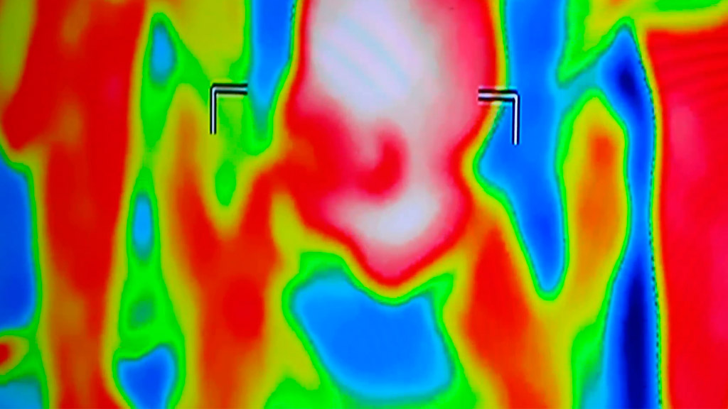 On Far Infrared Radiation Exposure Noxtak